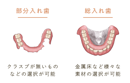 部分入れ歯：クラスプが無いものなどの選択が可能/総入れ歯：金属床など様々な素材の選択が可能