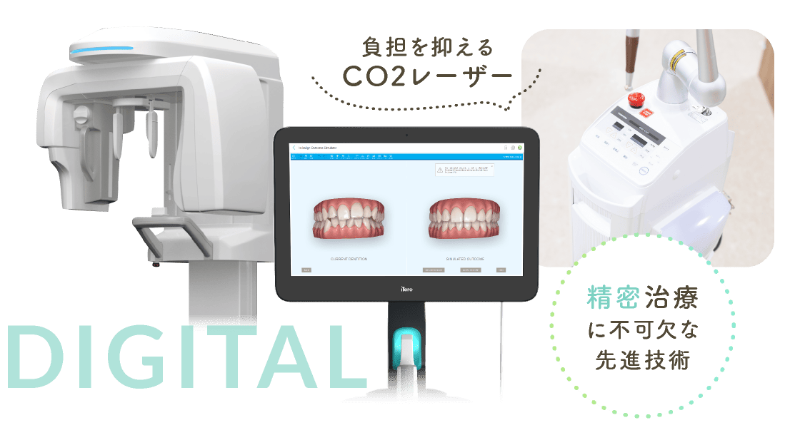 負担を抑えるCO2レーザー 精密治療に不可欠な先進技術
